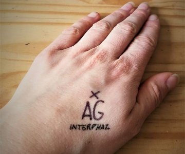 AG - Interphaz