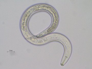 Les nématodes, ces vers qui ont colonisé le monde