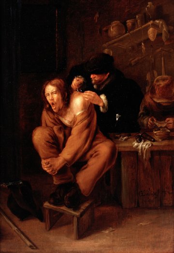 Visite libre de l'exposition "Le médecin face à la douleur, du 16e au 18e siècles"