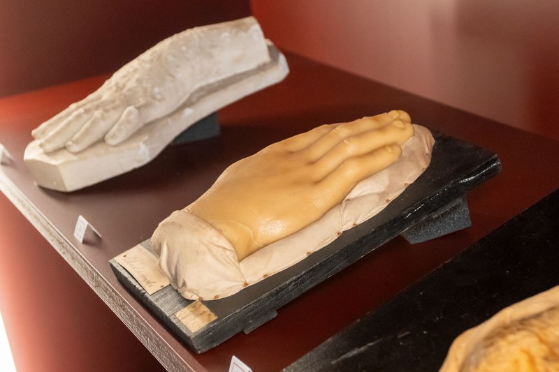 Objets de savoir, objets de fierté - les moulages médicaux